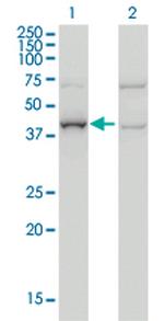 ARMC8 Monoclonal Antibody (2D9)