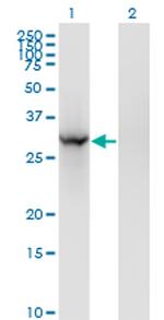 BRMS1 Monoclonal Antibody (2D4-2G11)