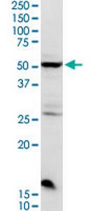 CHRDL2 Polyclonal Antibody, MaxPab™