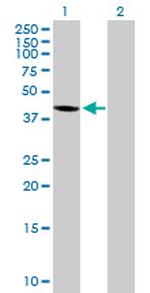 WDR51A Antibody in Western Blot (WB)