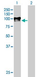 DKFZP586H2123 Antibody in Western Blot (WB)