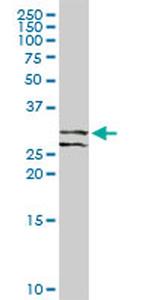 RCHY1 Antibody in Western Blot (WB)