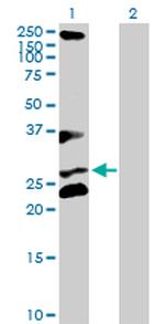 RCHY1 Polyclonal Antibody, MaxPab™