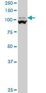MTHFD1L Monoclonal Antibody (1E8)