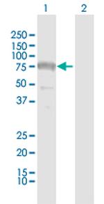SAMHD1 Antibody in Western Blot (WB)