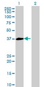 NECAP1 Antibody in Western Blot (WB)
