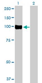 OSBPL3 Antibody in Western Blot (WB)