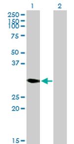 DECR2 Polyclonal Antibody, MaxPab™