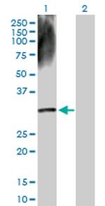 DECR2 Polyclonal Antibody, MaxPab™