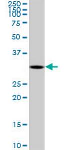 DECR2 Monoclonal Antibody (4A7)