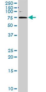 GGA1 Antibody in Western Blot (WB)