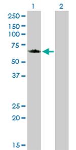 GGA1 Antibody in Western Blot (WB)