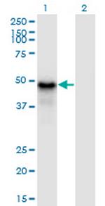 PYGO1 Monoclonal Antibody (3E1)