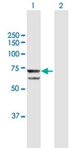 PRPF31 Polyclonal Antibody, MaxPab™