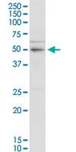 SERBP1 Polyclonal Antibody, MaxPab™
