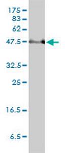 PAI-RBP1 Monoclonal Antibody (1D2-2E9)