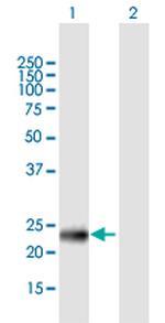 PHF19 Antibody in Western Blot (WB)