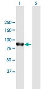 PTPN22 Polyclonal Antibody, MaxPab™