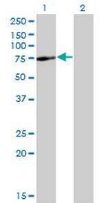 SPAG8 Antibody in Western Blot (WB)