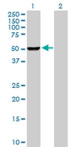 PHGDH Polyclonal Antibody, MaxPab™