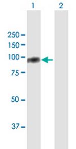 TIAM2 Antibody in Western Blot (WB)