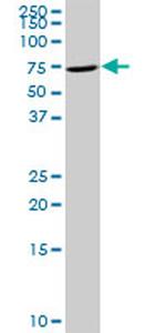 TIAM2 Antibody in Western Blot (WB)