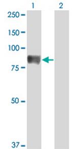 TIAM2 Antibody in Western Blot (WB)