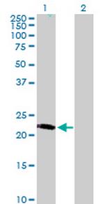 LRRC29 Polyclonal Antibody, MaxPab™