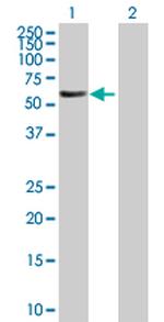 FBXL6 Antibody in Western Blot (WB)