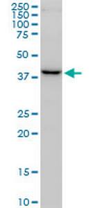 FBXO22 Monoclonal Antibody (6G9)