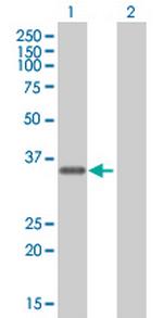 FBXO6 Polyclonal Antibody, MaxPab™