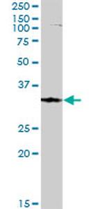 FBXO6 Antibody in Western Blot (WB)