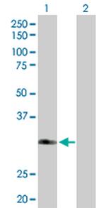 FBXO6 Polyclonal Antibody, MaxPab™