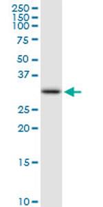 FBXO6 Antibody in Western Blot (WB)