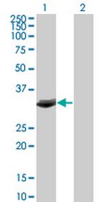FBXO6 Monoclonal Antibody (3F10)