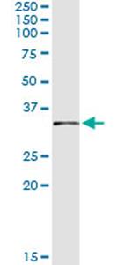 FBXO6 Antibody in Immunoprecipitation (IP)