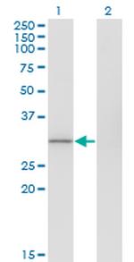 FBXO6 Antibody in Western Blot (WB)