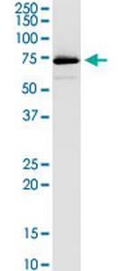 VPS33B Antibody in Western Blot (WB)