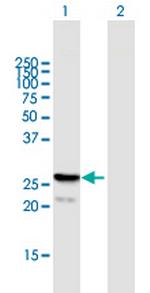 FGF21 Polyclonal Antibody, MaxPab™
