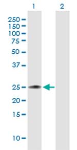 FGF21 Antibody in Western Blot (WB)