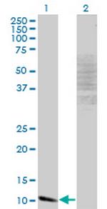 MYCBP Monoclonal Antibody (1B12)