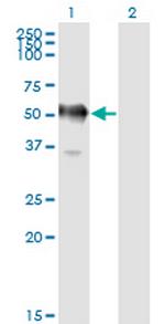 GAPDS Monoclonal Antibody (2E3-2E10)