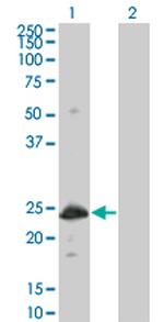 HSPB8 Monoclonal Antibody (5C3)