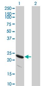 HSPB8 Antibody in Western Blot (WB)