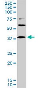 LHX6 Monoclonal Antibody (3D9)