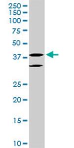 LHX6 Monoclonal Antibody (3E8)