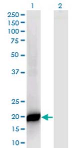 PPP1R14B Monoclonal Antibody (4G2)