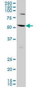 AATF Monoclonal Antibody (2H6)