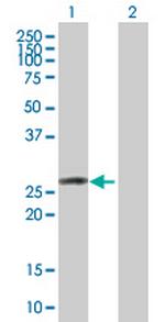 OSTF1 Antibody in Western Blot (WB)