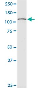 RPS6KC1 Antibody in Western Blot (WB)